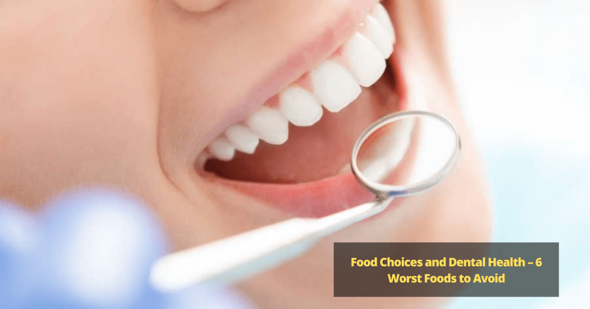 Food Choices and Dental Health – 6 Worst Foods to Avoid