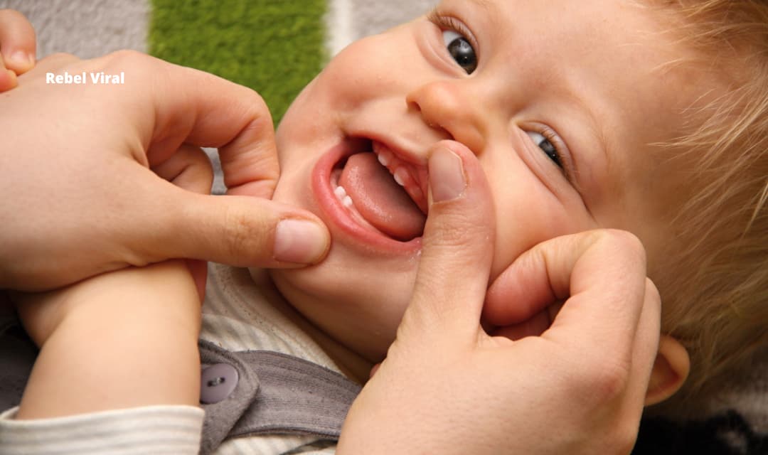 Lip Tie in Babies Vs Normal & Medical Term Symptoms