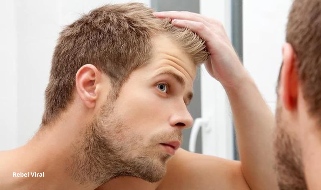 Why Do I Have Dandruff After Washing My Hair?