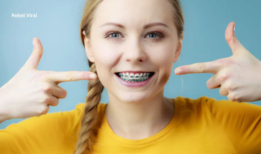 What to Eat When You First Get Braces?